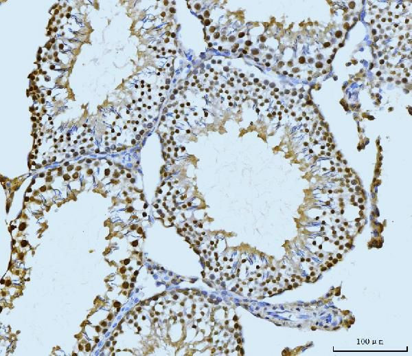 SBNO1 Antibody in Immunohistochemistry (Paraffin) (IHC (P))