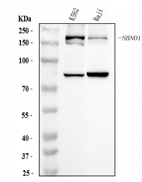 SBNO1 Antibody in Western Blot (WB)