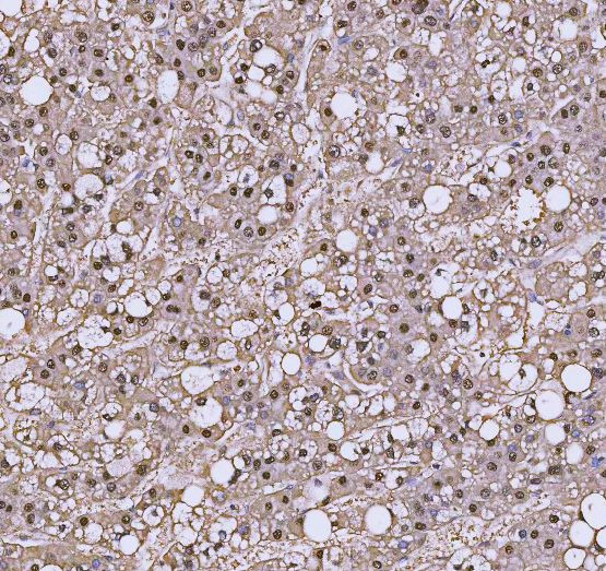 C19orf43 Antibody in Immunohistochemistry (Paraffin) (IHC (P))