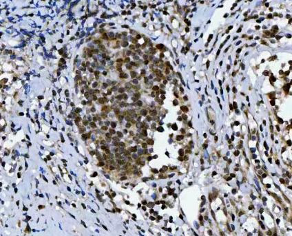 C19orf43 Antibody in Immunohistochemistry (Paraffin) (IHC (P))