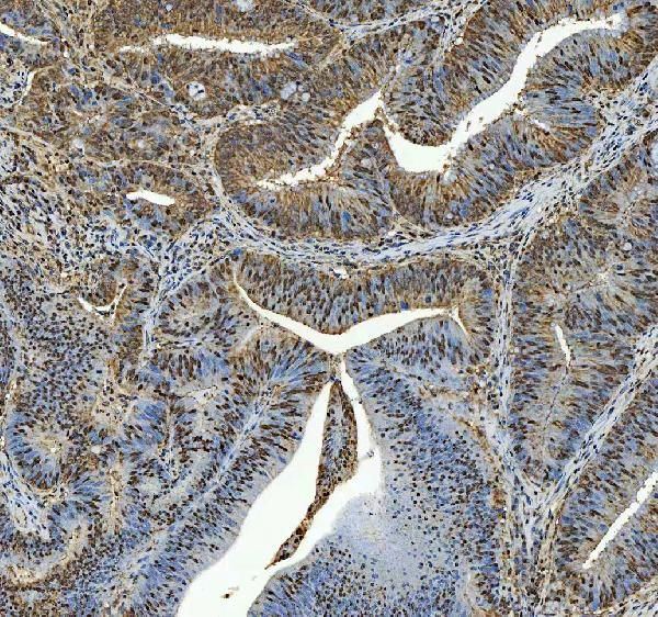 C19orf43 Antibody in Immunohistochemistry (Paraffin) (IHC (P))