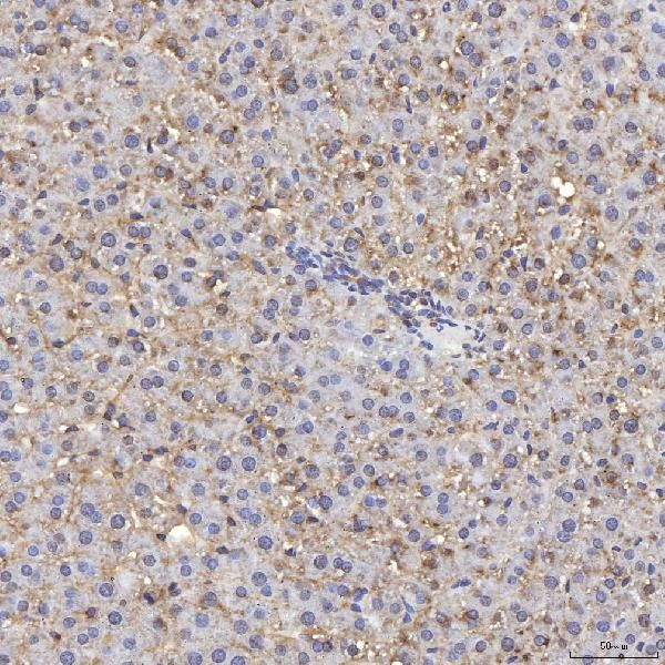 TIMD2 Antibody in Immunohistochemistry (Paraffin) (IHC (P))