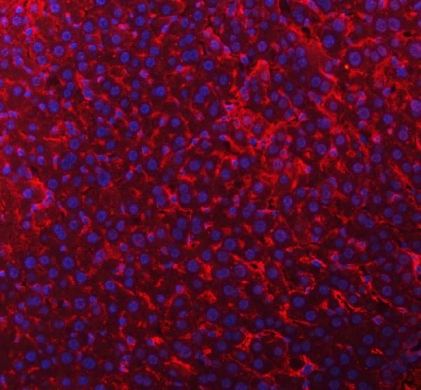 TIMD2 Antibody in Immunohistochemistry (Paraffin) (IHC (P))