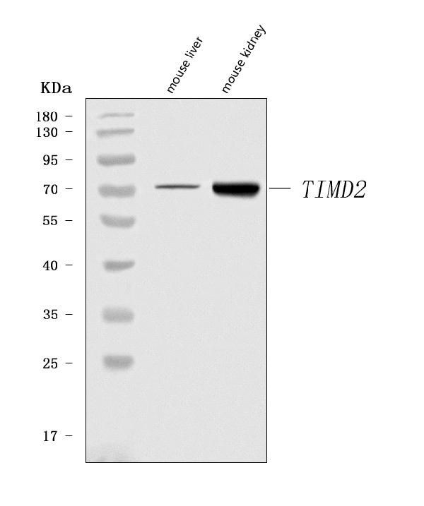 TIMD2 Antibody in Western Blot (WB)