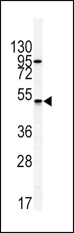 GIPR Antibody in Western Blot (WB)