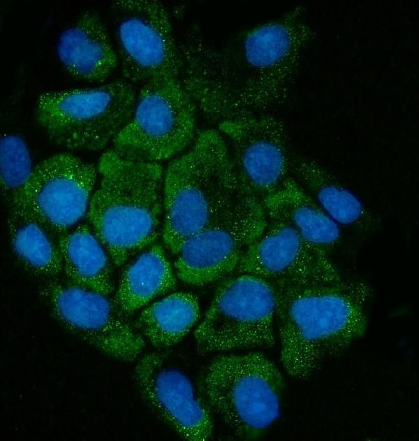 CTH Antibody in Immunocytochemistry (ICC/IF)