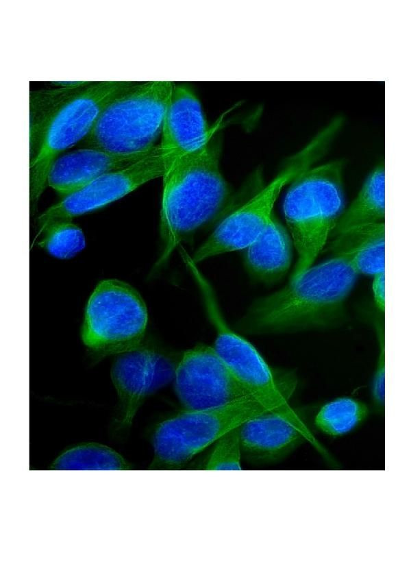 KV1.2 (KCNA2) Antibody in Immunocytochemistry (ICC/IF)