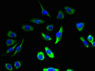 Calmodulin Antibody in Immunocytochemistry (ICC/IF)