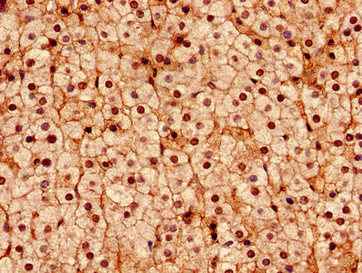 DDX3 Antibody in Immunohistochemistry (Paraffin) (IHC (P))