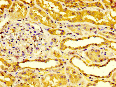 Endocan Antibody in Immunohistochemistry (Paraffin) (IHC (P))