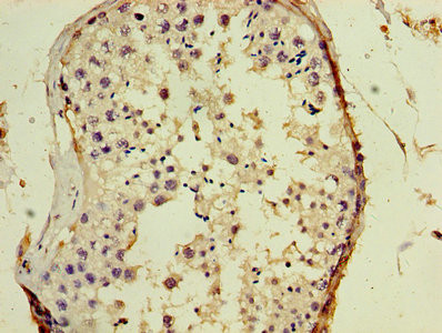 GAGE5 Antibody in Immunohistochemistry (Paraffin) (IHC (P))