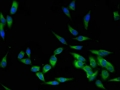 LCK Antibody in Immunocytochemistry (ICC/IF)