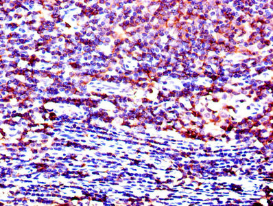 LCK Antibody in Immunohistochemistry (Paraffin) (IHC (P))