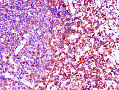 LCK Antibody in Immunohistochemistry (Paraffin) (IHC (P))