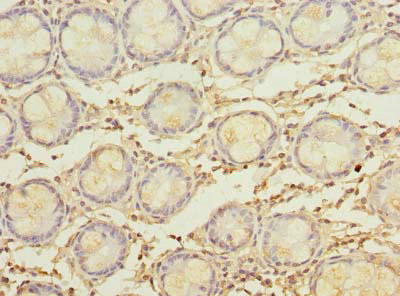 MYADM Antibody in Immunohistochemistry (Paraffin) (IHC (P))