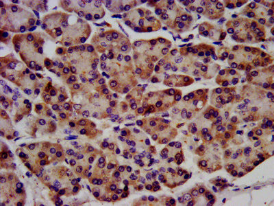 c-Raf Antibody in Immunohistochemistry (Paraffin) (IHC (P))