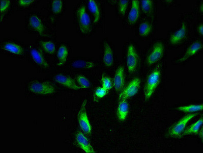 Complex III Antibody in Immunocytochemistry (ICC/IF)