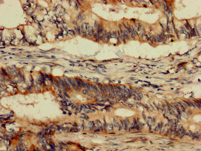 c-Abl Antibody in Immunohistochemistry (Paraffin) (IHC (P))