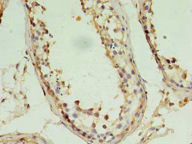 PIN1 Antibody in Immunohistochemistry (Paraffin) (IHC (P))