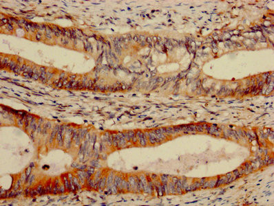 Galectin 7 Antibody in Immunohistochemistry (Paraffin) (IHC (P))