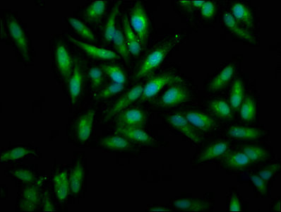 Mesothelin Antibody in Immunocytochemistry (ICC/IF)