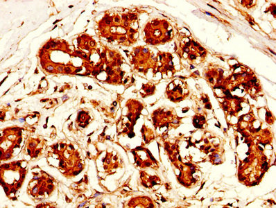 Mesothelin Antibody in Immunohistochemistry (Paraffin) (IHC (P))