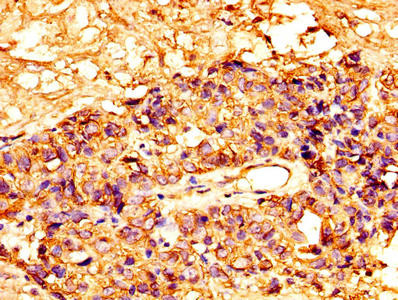 Mesothelin Antibody in Immunohistochemistry (Paraffin) (IHC (P))