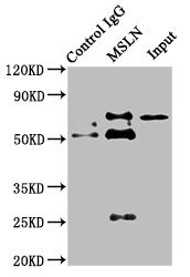 Mesothelin Antibody in Immunoprecipitation (IP)