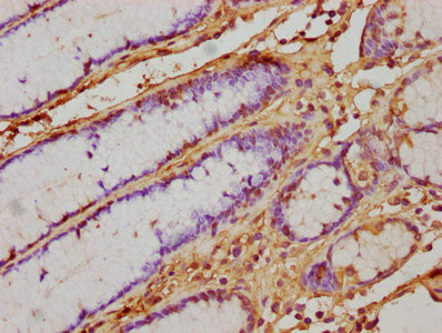 IFN alpha Antibody in Immunohistochemistry (Paraffin) (IHC (P))