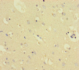 TXNDC8 Antibody in Immunohistochemistry (Paraffin) (IHC (P))