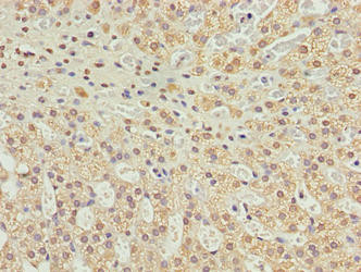 C10orf91 Antibody in Immunohistochemistry (Paraffin) (IHC (P))