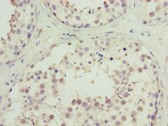 C10orf91 Antibody in Immunohistochemistry (Paraffin) (IHC (P))