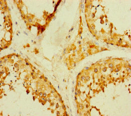 TADA2B Antibody in Immunohistochemistry (Paraffin) (IHC (P))