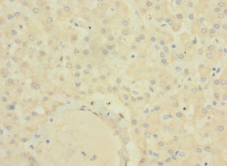 SLC22A9 Antibody in Immunohistochemistry (Paraffin) (IHC (P))