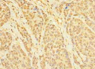 CCDC79 Antibody in Immunohistochemistry (Paraffin) (IHC (P))