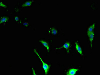 TSPAN14 Antibody in Immunocytochemistry (ICC/IF)