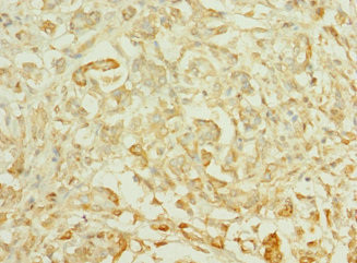 TTLL2 Antibody in Immunohistochemistry (Paraffin) (IHC (P))