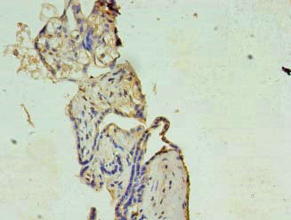 XAGE1 Antibody in Immunohistochemistry (Paraffin) (IHC (P))