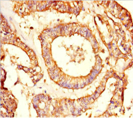 NRBP2 Antibody in Immunohistochemistry (Paraffin) (IHC (P))