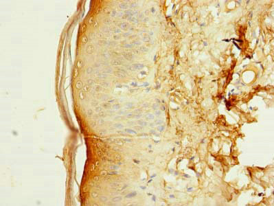 SLC38A7 Antibody in Immunohistochemistry (Paraffin) (IHC (P))