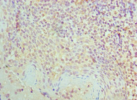 SMC1 Antibody in Immunohistochemistry (Paraffin) (IHC (P))