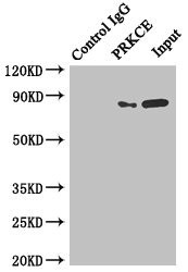 PKC epsilon Antibody in Immunoprecipitation (IP)