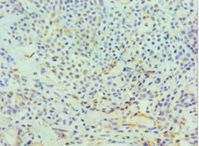 ICAD Antibody in Immunohistochemistry (Paraffin) (IHC (P))