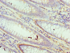 ICAD Antibody in Immunohistochemistry (Paraffin) (IHC (P))