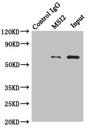 MKS1 Antibody in Immunoprecipitation (IP)