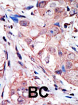 JNK3 Antibody in Immunohistochemistry (Paraffin) (IHC (P))