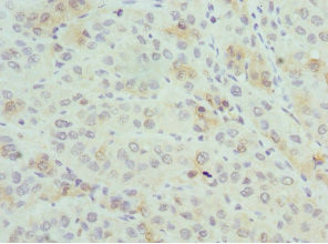 PSME1 Antibody in Immunohistochemistry (Paraffin) (IHC (P))