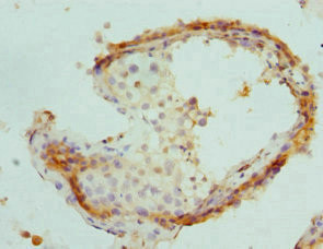 PSME1 Antibody in Immunohistochemistry (Paraffin) (IHC (P))