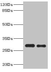 PSME1 Antibody in Western Blot (WB)