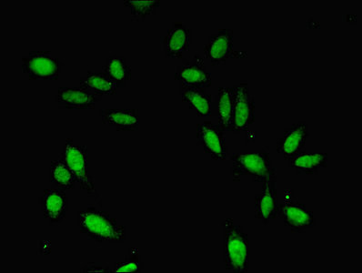 Cdc45L Antibody in Immunocytochemistry (ICC/IF)